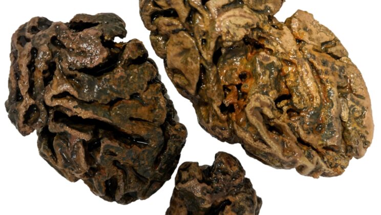New Study Reveals Massive Collection of Preserved Brains, Spanning 12,000 Years